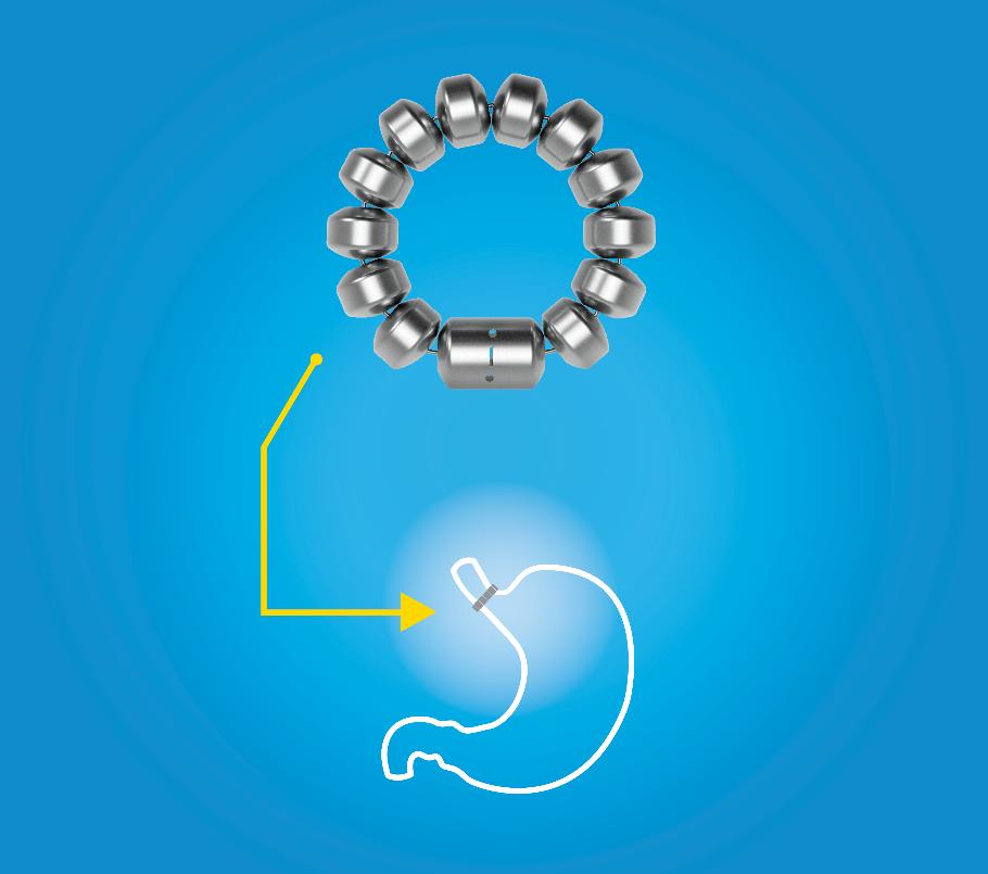 How LINX works